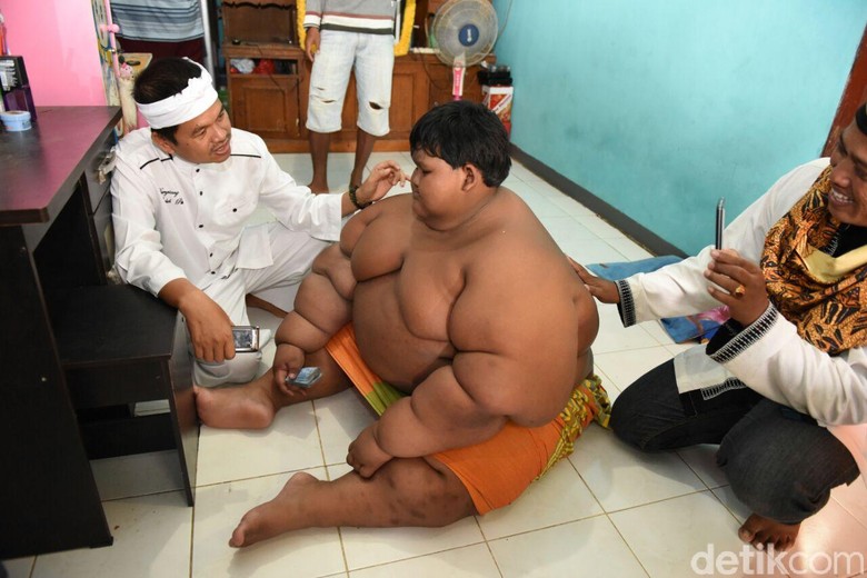 Bupati Dedi Kunjungi Ariya Si Bocah 188 Kg, Siapkan Ahli Gizi dan Bantu Asupan