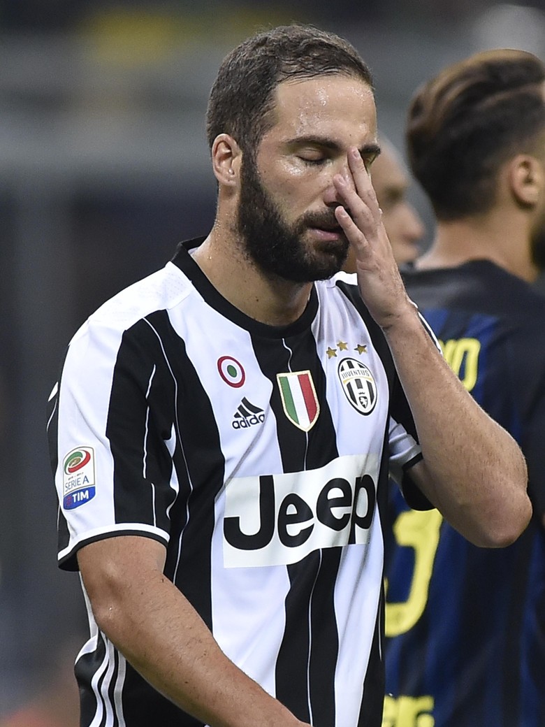 Allegri Bela Keputusannya soal Higuain Allegri Bela Keputusannya soal Higuain