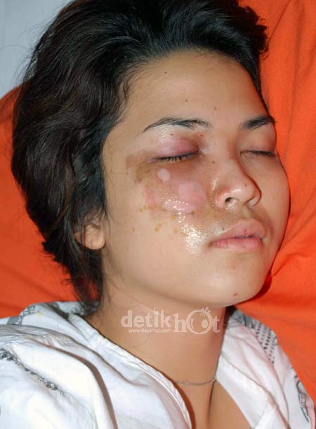 detikHot : hiburan digital anda | Menjenguk Dinda Kanya Dewifoto dinda kanya dewi 