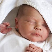 Kelainan+pada+bayi+baru+lahir