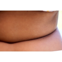 lemak perut (ts) dalam Lemak Perut Bikin Orang Lemot