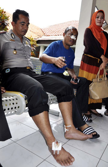 Korban Luka Bom di Masjid Polresta Cirebon