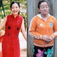 Phuong daily dlm Kulit Wanita Berusia 23 Keriput Seperti Nenek 73 Tahun Karena Salah Obat