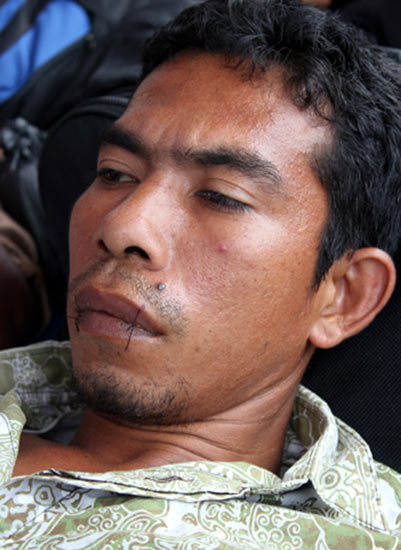 Jahit Mulut Tuntut Menhut