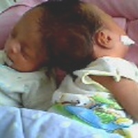 http://images.detik.com/content/2012/01/11/1300/kembarsiamdetikhealthdlm.jpg