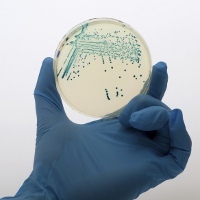 http://images.detik.com/content/2012/04/13/763/e-coli--ts--dlm.jpg