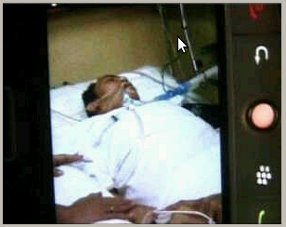 Setahun Terserang Diabetes  Stroke, Tata Dado Terbaring Lemah di Tempat Tidur