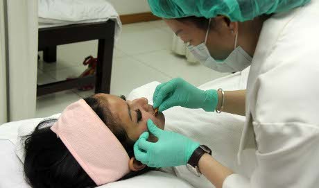 Bikin Wajah Kencang, Five Vi Lakukan Tanam Benang