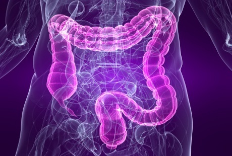 Recognize the Risk Factors and Symptoms of Colorectal Cancer is Here