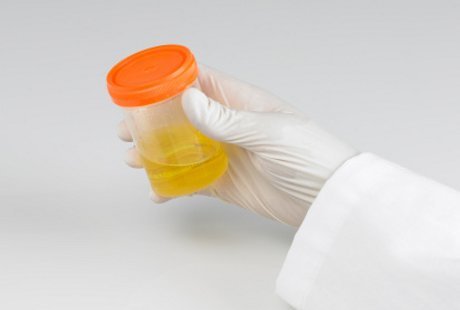 http://images.detik.com/content/2013/12/04/763/130150_urine2ts.jpg?w=500