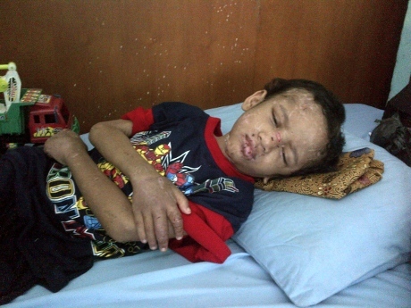 VIDEO PENGANIAYAAN ADIT YANG DIBUANG DI KEBUN SAWIT RIAU Hasil Medis Adit Lidah Terpotong, Bibir dan Alat Vital Disayat.