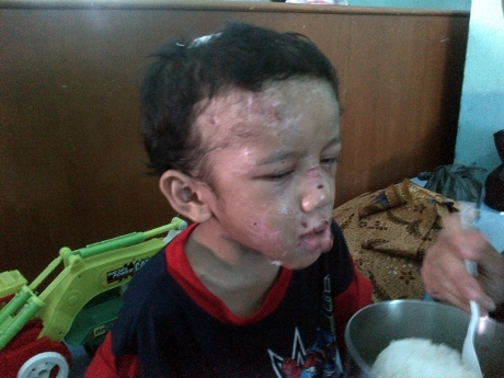 Hasil Medis Adit Lidah Terpotong, Bibir dan Alat Vital Disayat