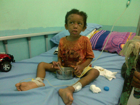 PENYEBAB PENGANIAYAAN ADIT YANG DIBUANG DI KEBUN SAWIT RIAU Hasil Medis Adit Lidah Terpotong, Bibir dan Alat Vital Disayat.