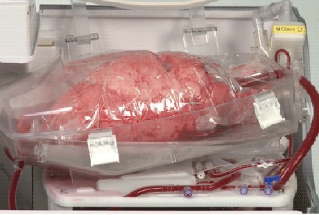 Kotak Ajaib, Selamatkan Organ Manusia Dalam Gudang