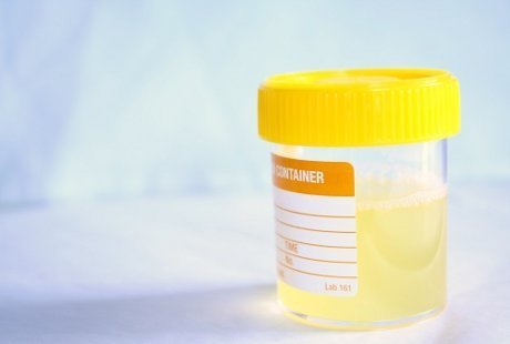 Meneropong Kondisi Tubuh Melalui Urine