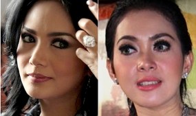 10 Fenomena Operasi Plastik Artis Indonesia 10 Fenomena Operasi Plastik Artis Indonesia