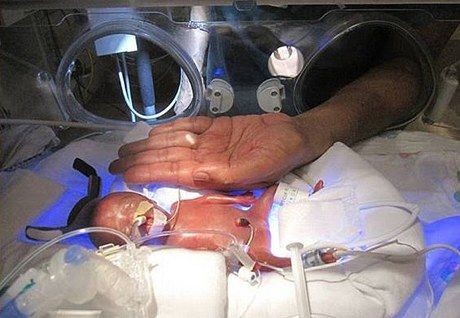 VIDEO BAYI TERMUNGIL KETIGA DI DUNIA LAHIR DI AS 2012 Melinda Star Guido Nama Bayi Termungil