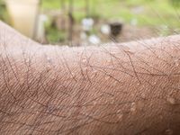 Para Ilmuwan 'Temukan' Organ Penting Baru di Tubuh Manusia