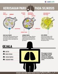 Pneumokoniosis, Alasan Mengapa Pekerja Proyek Perlu Pakai Masker