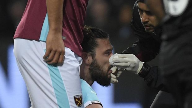Lini pertahanan Chelsea membuat Andy Carroll sampai berdarah-darah.
