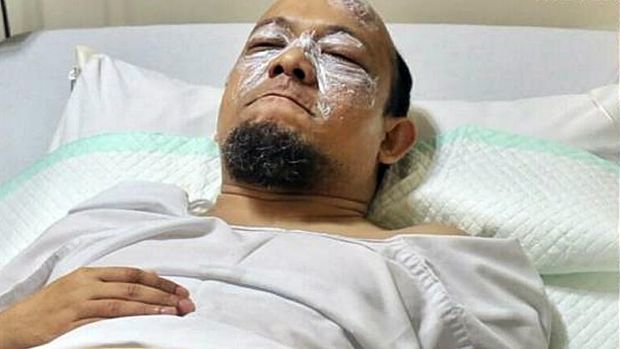 Novel Baswedan menjalani perawatan terkait dengan penyerangan air keras ke mukanya.