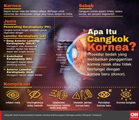 Mengenal Cangkok Kornea yang Mungkin Dihadapi Novel Baswedan