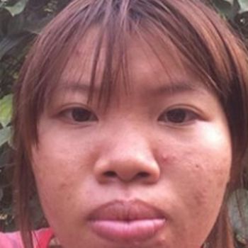 Sering Dihina Jelek  Wanita  Vietnam Habiskan Rp 191 Juta 