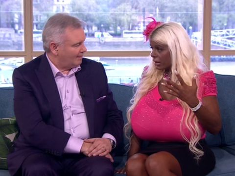 Wanita dengan Payudara Sebesar Bola Voli Ini Bikin <i>Shock</i>