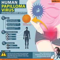 Kanker serviks dipicu oleh infeksi HPV (Human Papilloma Virus)