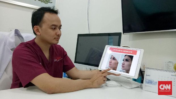 Suntik Filler Aman, tapi Patut Waspada Kepanasan