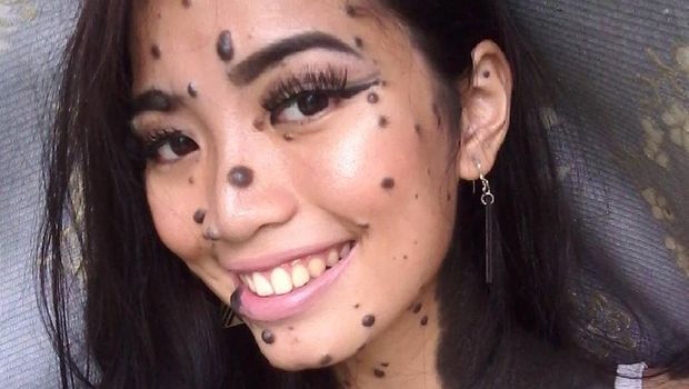 Mengenal Kondisi Langka di Balik Tahi Lalat si Cantik Evita