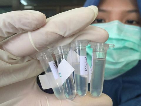 Lem operasi alias surgical glue dapat membantu proses pemulihan luka pada pasien jantung bocor anak