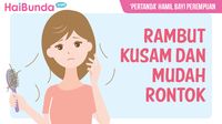Kondisi Ini Dipercaya Jadi Tanda Hamil Bayi Perempuan./Foto: Infografis