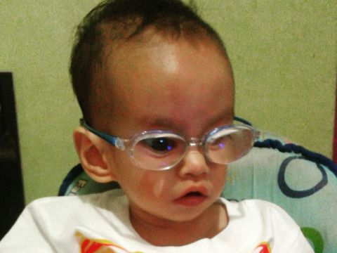 Abyn kena katarak sejak bayi/