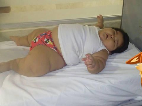 Bayi 10 bulan yang beratnya seperti anak 9 tahun/