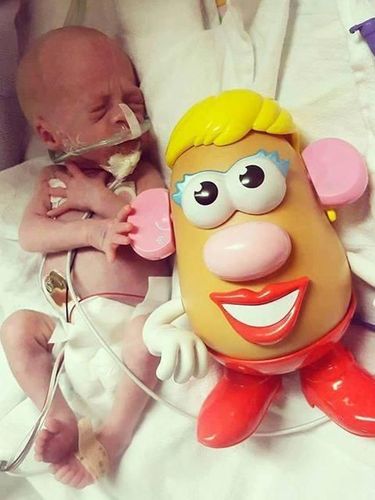 Saat Tokoh Kartun Mr Potato Head Bantu Pantau Perkembangan Bayi Prematur