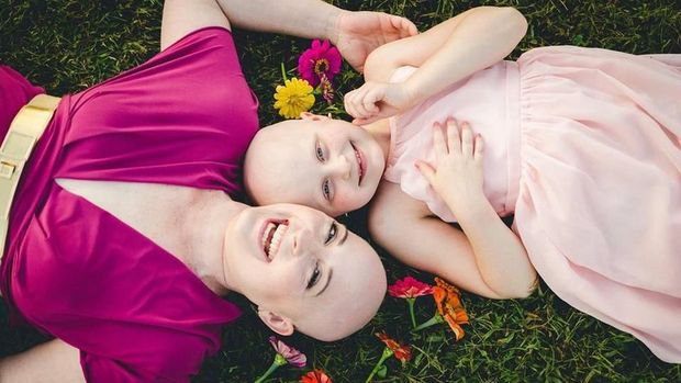 Cerita Haru di Balik Foto Ibu dan Anak yang Sama-Sama Botak