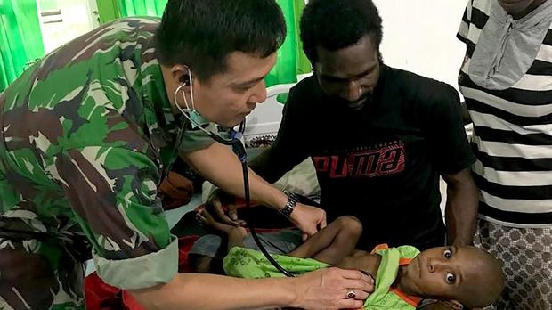 Wabah Campak dan Gizi Buruk Asmat Sebabkan 68 Meninggal