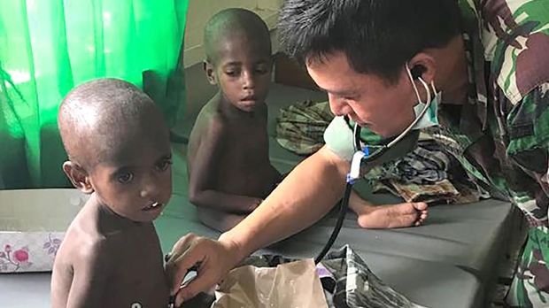 Moeldoko Sebut Gizi Buruk di Asmat karena Warga Tak Peduli