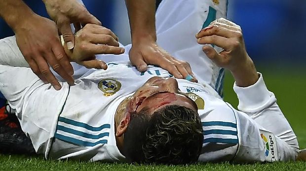Cristiano Ronaldo mengalami cedera di kepala usai mencetak gol kedua ke gawang Real Betis. (