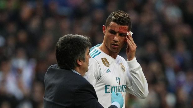 Kepala Cristiano Ronaldo berdarah setelah terkena tendangan bek Deportivo La Coruna, Fabian Schaer, saat ia menanduk bola. (