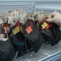 Bisakah Donor Ginjal Kalau Golongan Darahnya Beda? Bisakah Donor Ginjal Kalau Golongan Darahnya Beda?