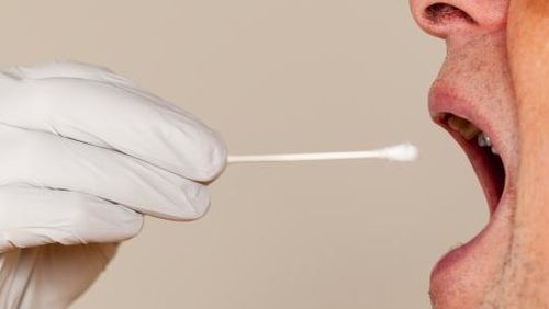Dokter: Sakit Gula dan Ginjal Tidak Bisa Dilihat dari Air Liur Dokter: Sakit Gula dan Ginjal Tidak Bisa Dilihat dari Air Liur