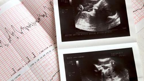 Perempuan-perempuan Ini Pernah Mengandung Mumi Bayi 1 Perempuan-perempuan Ini Pernah Mengandung Mumi Bayi 1
