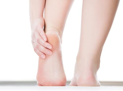 Kaki Terasa Sakit Bila Terlalu Banyak Jalan, Tanda Osteoporosis? Kaki Terasa Sakit Bila Terlalu Banyak Jalan, Tanda Osteoporosis?