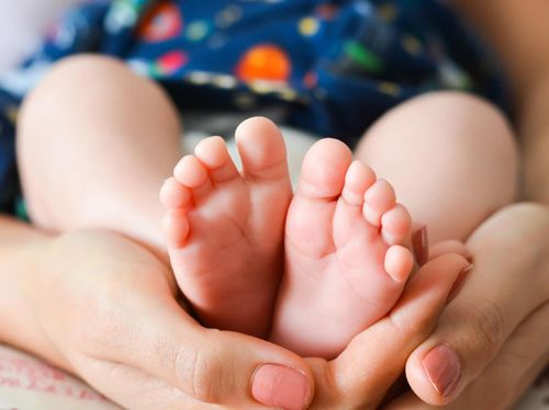 Kenali, Berbagai Penyebab Kasus Clubfoot pada Bayi Kenali, Berbagai Penyebab Kasus Clubfoot pada Bayi