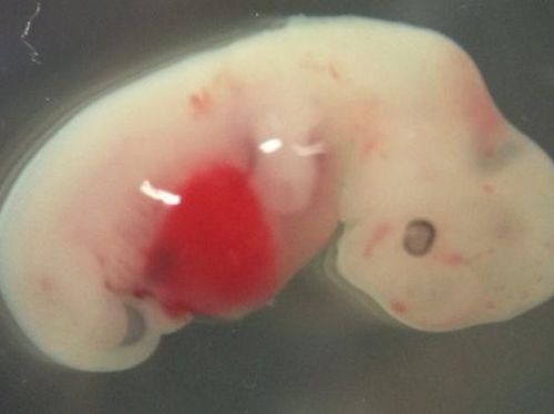 Embrio Chimera Manusia-Babi Berhasil Diciptakan