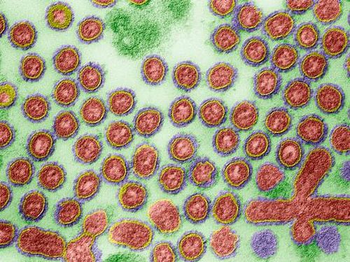 Indonesia Harus Siap dan Sigap Menghadapi Pandemi Influenza Baru Indonesia Harus Siap dan Sigap Menghadapi Pandemi Influenza Baru