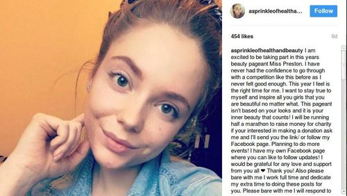 Wanita Ini Ungkap Diet Vegan Bantu Atasi Jerawat yang Penuhi Wajahnya Wanita Ini Ungkap Diet Vegan Bantu Atasi Jerawat yang Penuhi Wajahnya