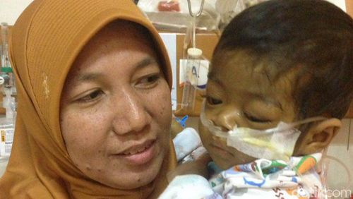 Perjuangan Naura Selesai, Bayi Pengidap Atresia Bilier Ini Telah Berpulang Perjuangan Naura Selesai, Bayi Pengidap Atresia Bilier Ini Telah Berpulang
